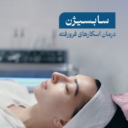 سابسیژن